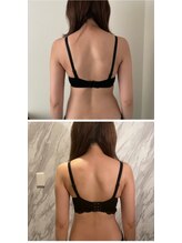 エグゼ アムール エム アンベリーノ 大阪店(Exe amour M)/姿勢改善