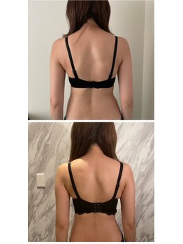 エグゼ アムール エム アンベリーノ 大阪店(Exe amour M)/姿勢改善