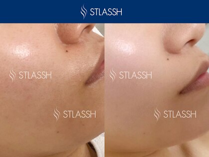 ストラッシュ 刈谷店(STLASSH)の写真