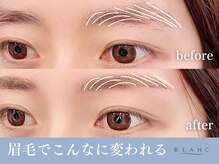 ブラン 長野東口店(Blanc)/アイブロウ・ビフォーアフター