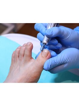 フットケアを受けたい