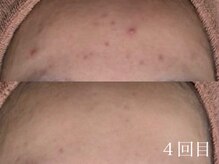 ホワイトアクア 四日市店(WHITE AQUA)/圧倒的結果重視