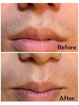 ルタンリッシュオム(Lutan Riche hom)/12回~18回がおすすめ