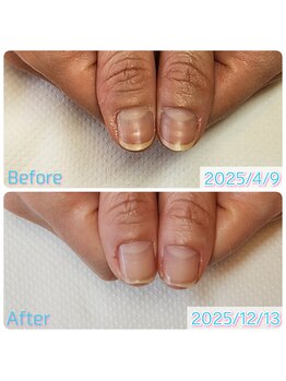 スペシャルハンドケア