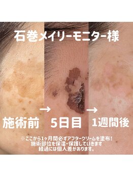 メイリー(Maylie)/WHITELABモニター/石巻メイリー