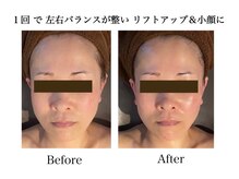 ナチュラーレ 天王寺店(Naturale)/美肌ニキビケア小顔フェイシャル