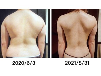 ビースタイル(b-style)/ビフォーアフター