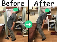 杉本接骨鍼灸院/産後骨盤矯正・坐骨の痛み