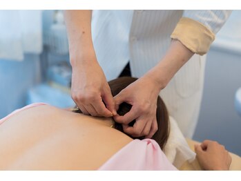 ブレア 元町/首こり、肩こりの鍼施術