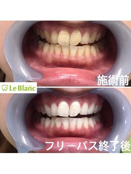 ルブラン 奈良店(Le Blanc)/日焼けも一切しない