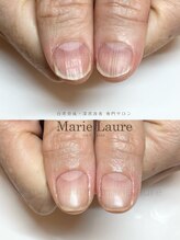 マリーロール 梅田店(Marie Laure)/深爪矯正/自爪育成/自爪風