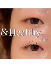 モナ(MoNa)/アンドヘルシー(&healthy)