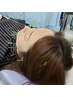 【全身スッキリ贅沢コース】美容鍼+全身整体マッサージ　120分