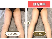 HGB 東山公園駅前店/男性｜30代｜会社員