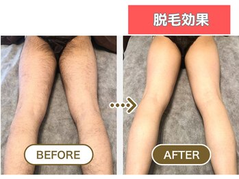 HGB 東山公園駅前店/男性｜30代｜会社員