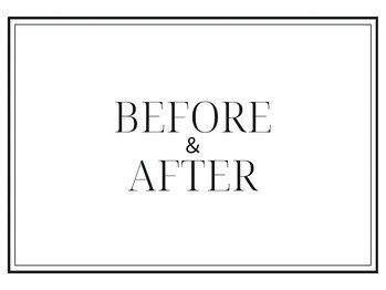 アルピナ(ALPINA)/ウルトランスフォーマー