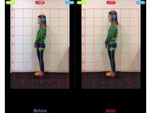 ケアルーム 綱島(CARE room)/施術効果写真☆（before after）