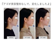 エピファニー(Epiphany)/20代　首肩こり頭痛エラが悩み…