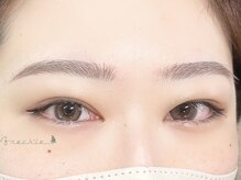 フレックル(freckle)