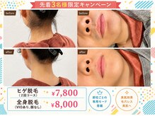 ワイズサロン(Y's salon)