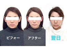 ビューティスタジオＫ/小顔矯正ビフォーアフター