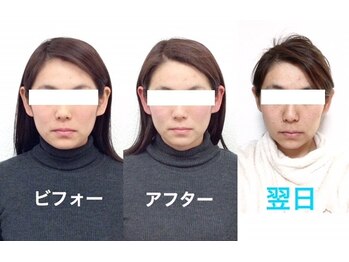 ビューティスタジオＫ/小顔矯正ビフォーアフター