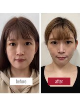 サロンチオリ 烏丸(Salon Chiori)/《30代》フェイスライン小顔矯正