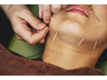 鍼灸治療院 森空堂 本院/美容鍼は日々バージョンアップ！