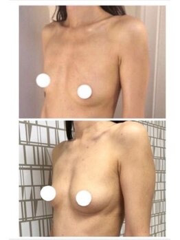 エスビューティー 三軒茶屋(S beauty)/バストケア・世田谷・痩身