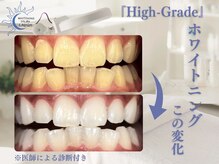ラフ(LAUGH)