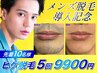 【メンズ脱毛導入記念10名限定】脱毛初心大歓迎ヒゲ脱毛体験 5回コース¥9900