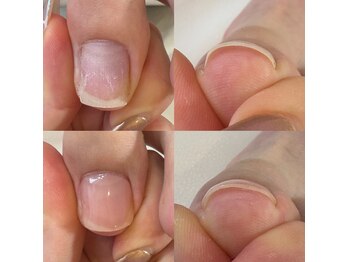 リッシュ トロワ(RICHE trois)/特集ジェルで巻き爪ケア