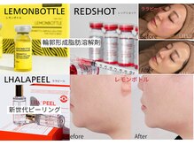 ナチュール(NaTuRu)の雰囲気(韓国肌管理ララピール/レモンボトル/レッドショット新導入)