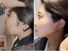 エヴァワックス 大阪 南堀江店(Eva Wax)/脱毛/ブラジリアンワックス