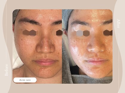 キュレイテッドスキン(CURATED SKIN)の写真