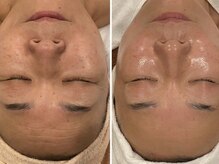 トータルエステティック ジョワイユ(JOYEUX)