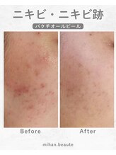 ミハン ボーテ(mihan.beaute)/