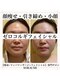 ソラウミ(SORAUMI)の写真/本気の小顔ケア！韓国小顔ゼロコルギフェイシャルで、自信あふれるツヤ肌に☆最短で理想のフェイスラインに