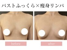 ミミー