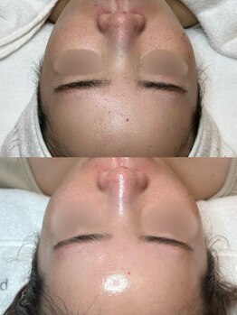 プルスキンサロン 大阪店(pull skin salon)の写真/自社スキンケアブランド【pull】をはじめ,サロン専売品アイテムを豊富にご準備!内側+外側のケアをご提案!