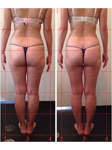 ジェイオー(J.O)/痩身コルギ/美脚コルギ/リンパ