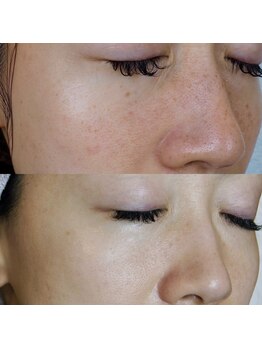 エトル(etole)/30代お客様症例写真