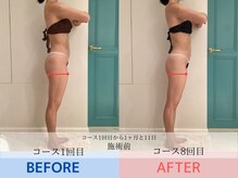 エル 麻布十番(LllL)/【痩身】1ヶ月ビフォアフ