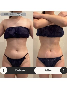 ラヴニール(L'avenir)/半年でマイナス7kg!?