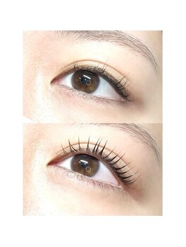 アンフィズム(annfism)/