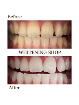 ホワイトニングショップ 四条店/