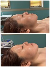 吉川美南ライフ整骨院/30代女性