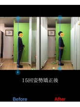 北てんま整骨鍼灸院/反り腰改善！！