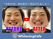 ホワイトニングカフェ 葛西店(WhiteningCafe)/☆ホワイトニングカフェ葛西店☆