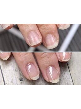 爪の悩みを解消できる（ケア含む）